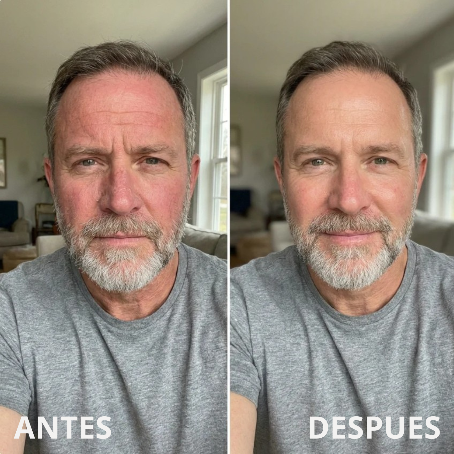 Crema de Sebo Bovino y Miel™