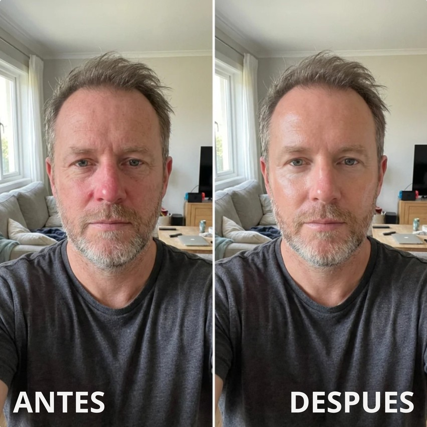 Crema de Sebo Bovino y Miel™